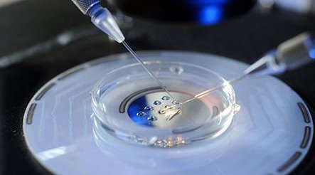 详细解读枣阳市做长方案试管婴儿费用，长方案和短方案成功率有差别吗？