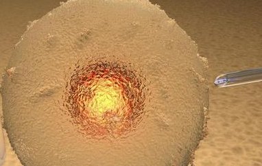 取卵的危害比你想象的大，会不会导致不孕一文说清楚